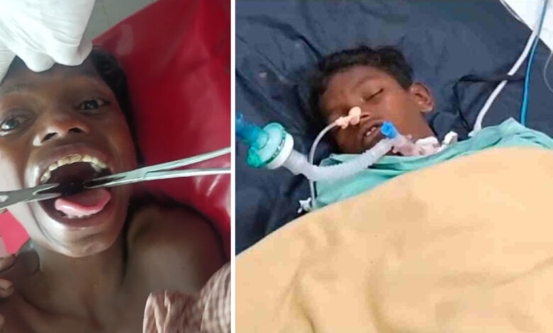 Doctors succeed in removing fish stuck in child's throat, child's condition stable.